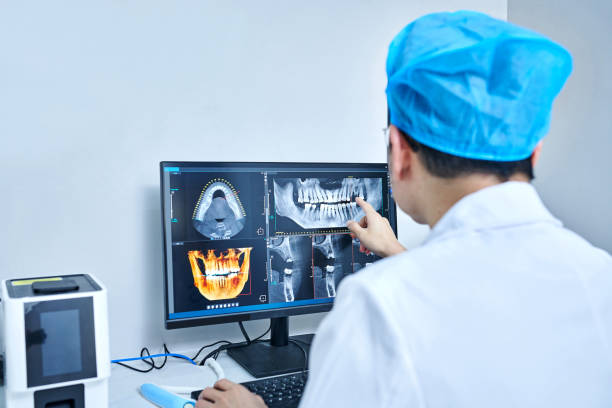 Best Emergency Tooth Extraction in Hickory Hls, IL